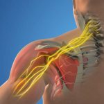 Why Patients Choose Michael J. Bercik Jr., MD in Lancaster for Shoulder Care