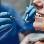 Why One-Size-Fits-All Doesn’t Work in Dental Treatments